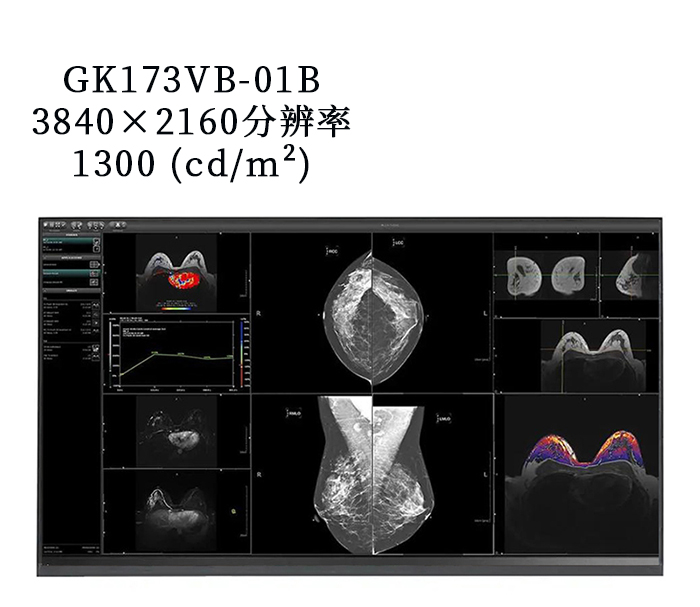 17.3寸GK173VB-01B